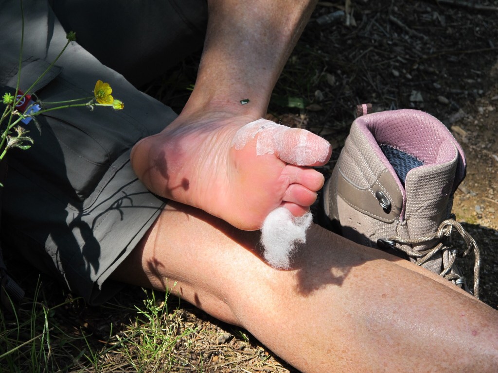 MR's new boots have played havoc ... only by the grace of God go I!